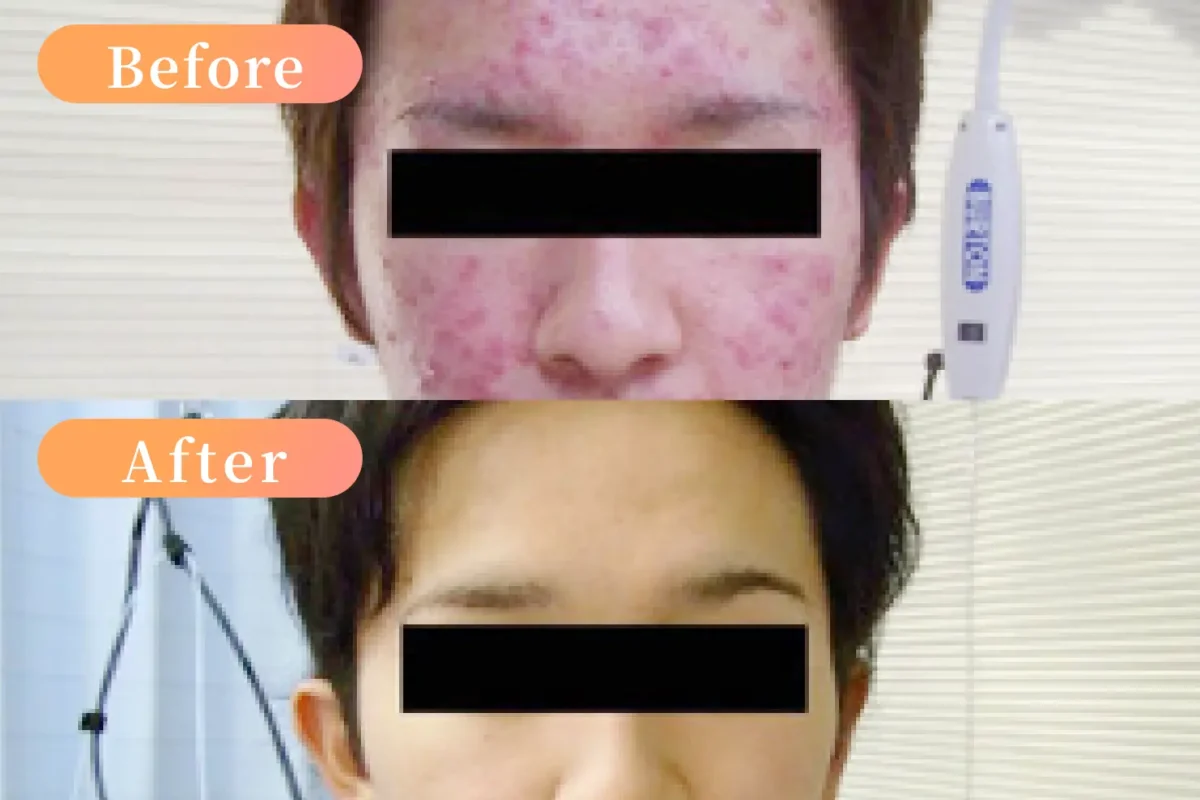 20代　男性　2年後